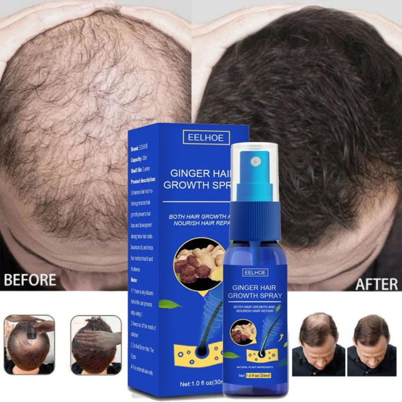 Epidermal Growth Factor - Ingwer Haar Wachstum Serum Spray Anti