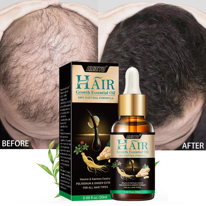 Epidermal Growth Factor - 2023 Biotin schnelles Haarwuchs öl nachwachsen