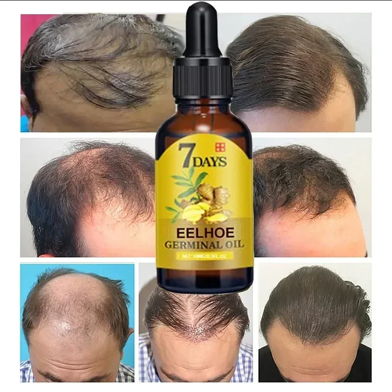 7 Tage schnelles Haarwuchs öl  – Epidermal Growth Factor Bewertung und Preis