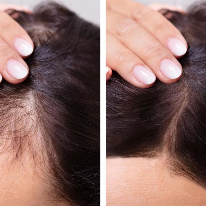 2023 Biotin schnelles Haarwuch – Epidermal Growth Factor Bewertung und Preis