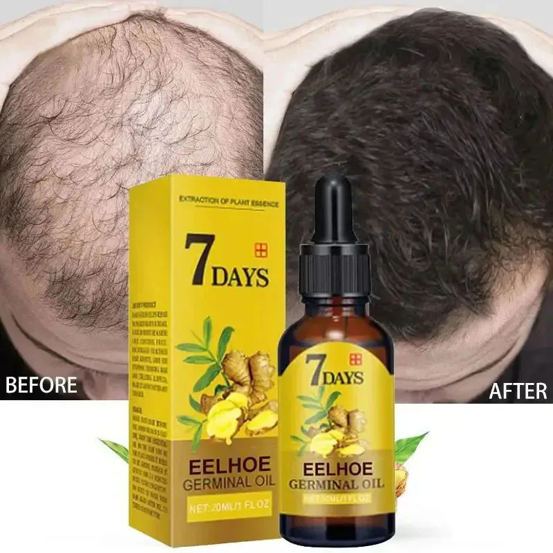 7-Tage Schnelles Haarwuchsseru – Epidermal Growth Factor Bewertung und Preis